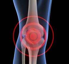 Zimmer NexGen Knee: severe complications threat